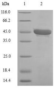 SDS-PAGE