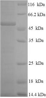 SDS-PAGE