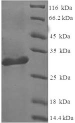SDS-PAGE