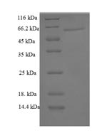 SDS-PAGE