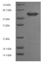 SDS-PAGE