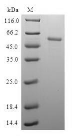 SDS-PAGE