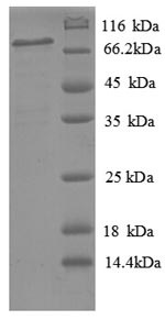 SDS-PAGE