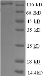 SDS-PAGE