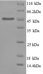 SDS-PAGE