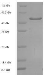 SDS-PAGE