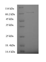 SDS-PAGE