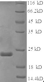 SDS-PAGE
