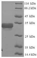 SDS-PAGE