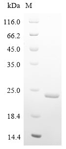 SDS-PAGE
