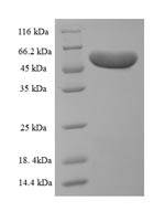 SDS-PAGE