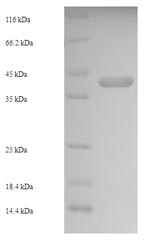 SDS-PAGE