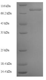 SDS-PAGE