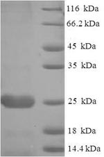 SDS-PAGE