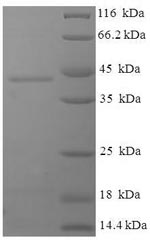 SDS-PAGE
