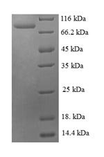 SDS-PAGE