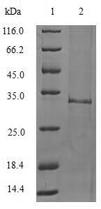 SDS-PAGE