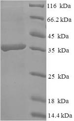 SDS-PAGE