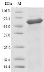 SDS-PAGE