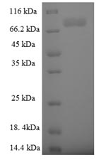 SDS-PAGE