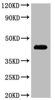 Western Blot