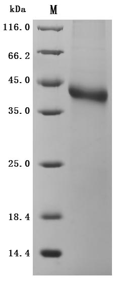 SDS-PAGE
