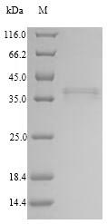 SDS-PAGE