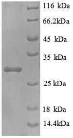SDS-PAGE