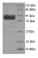 SDS-PAGE