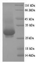 SDS-PAGE