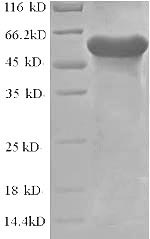 SDS-PAGE