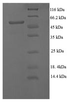 SDS-PAGE