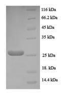 SDS-PAGE