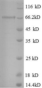 SDS-PAGE