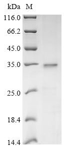 SDS-PAGE