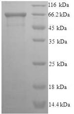 SDS-PAGE