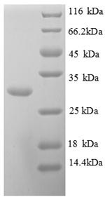 SDS-PAGE