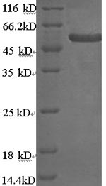SDS-PAGE