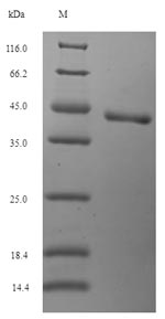 SDS-PAGE