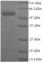 SDS-PAGE