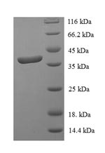 SDS-PAGE