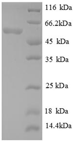 SDS-PAGE