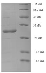 SDS-PAGE