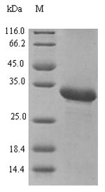SDS-PAGE