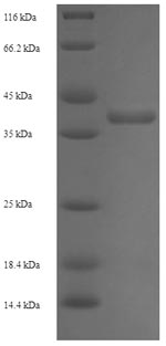 SDS-PAGE