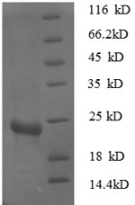 SDS-PAGE
