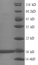 SDS-PAGE