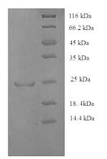 SDS-PAGE