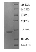 SDS-PAGE