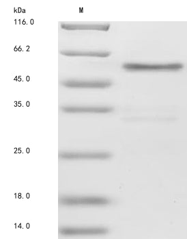 SDS-PAGE